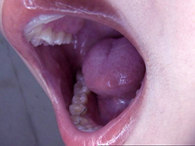 300人のおくち　3　サンプル画像17